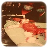 圖：紀念照片西元1995年1月8日麻醉科四個月大女嬰接受長時間腎臟手術