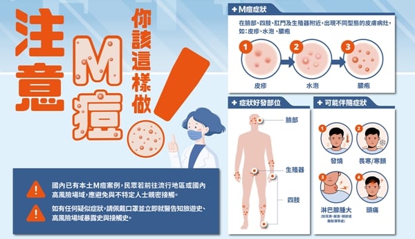 圖片：「猴痘」為第二類法定傳染病